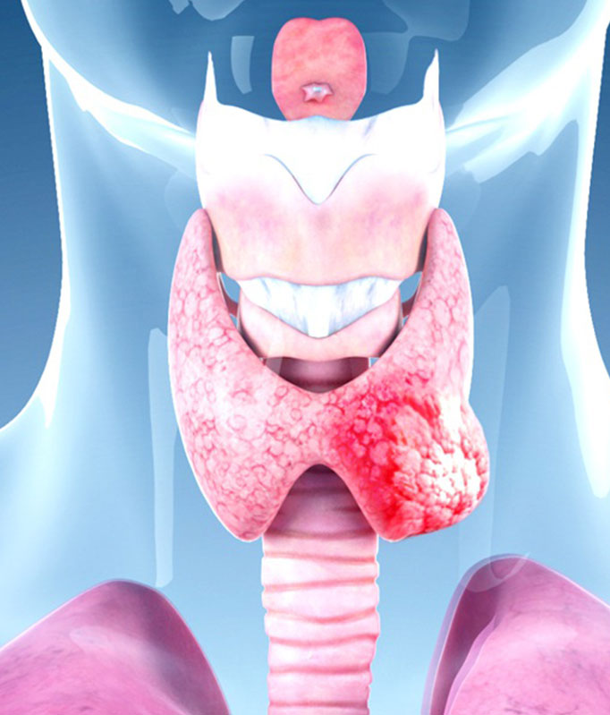 prostate medical rendering