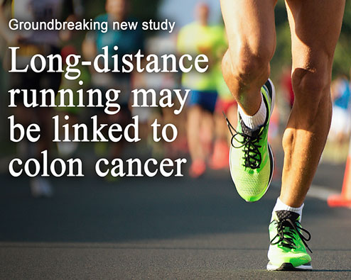 Colon cancer research graphic