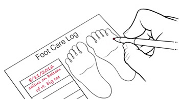 foot care log